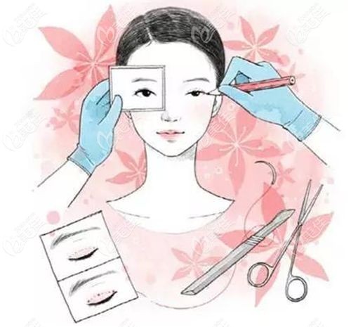 石恒眼整形价目表