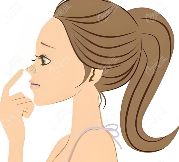 李信鋒鼻修復(fù)手術(shù) 李信鋒鼻修復(fù)手術(shù)