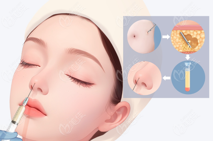 李信鋒小助理微信預(yù)約 李信鋒小助理微信預(yù)約