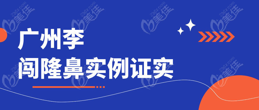 广州李闯隆鼻实例证实
