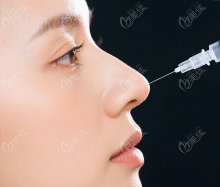 上海陳向東醫(yī)生注射鼻子怎么樣 上海陳向東醫(yī)生注射鼻子怎么樣