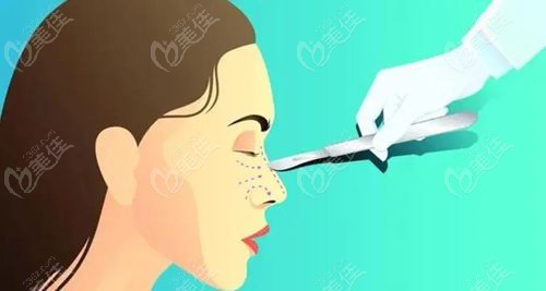 范荣杰做鼻子属于几线档次
