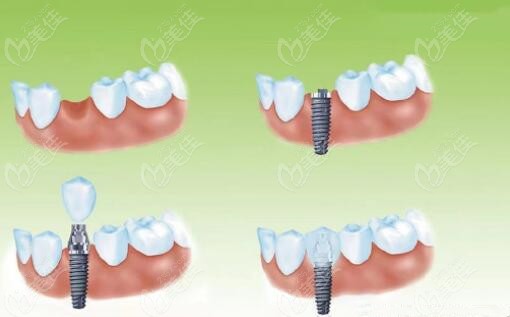 海南華美口腔怎么樣 海南華美口腔怎么樣