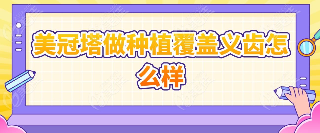 美冠塔做种植覆盖义齿怎么样