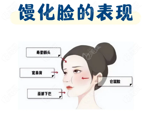 馒化针VS轻薄针的区别