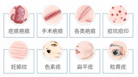 上海江城医院疤痕修复正规