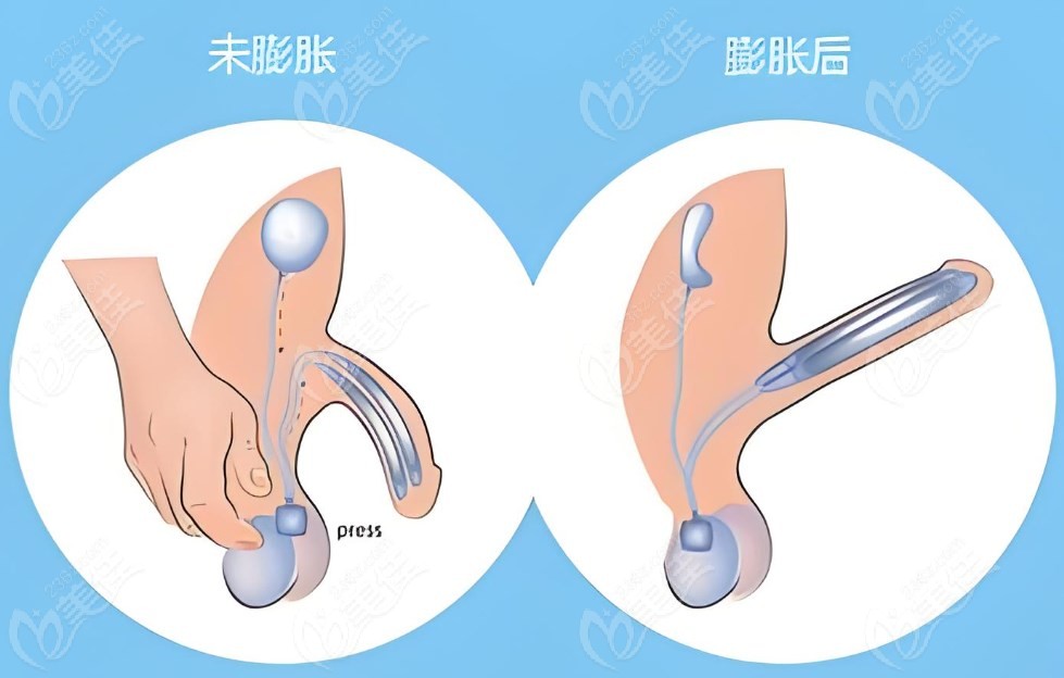 九龙男科医院正规可靠不坑人可信
