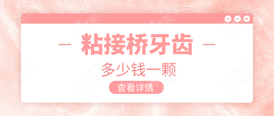 粘接桥牙齿多少钱一颗