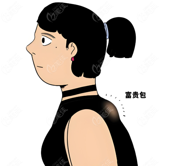 富貴包的整形醫(yī)生
