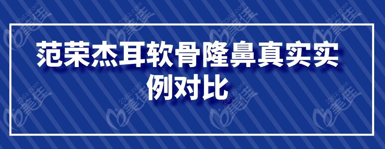 范荣杰耳软骨隆鼻真实实例对比