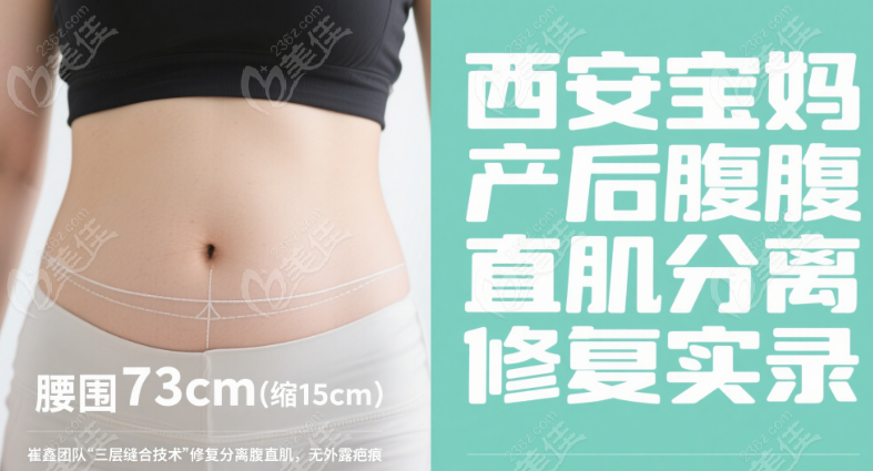 腹壁成形手術(shù)術(shù)后療效