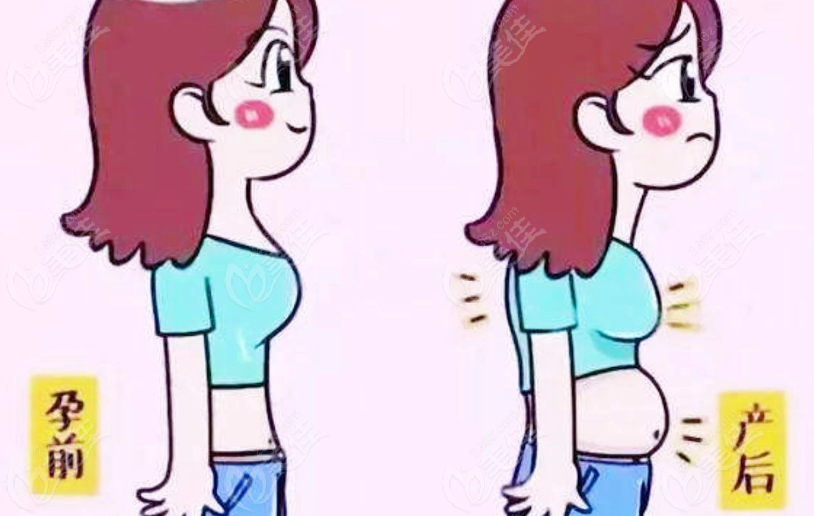 【崔鑫醫(yī)生經(jīng)腹假體隆乳術(shù)】技術(shù)優(yōu)勢(shì)：適合產(chǎn)后寶媽腹部+隆胸同時(shí)修復(fù)