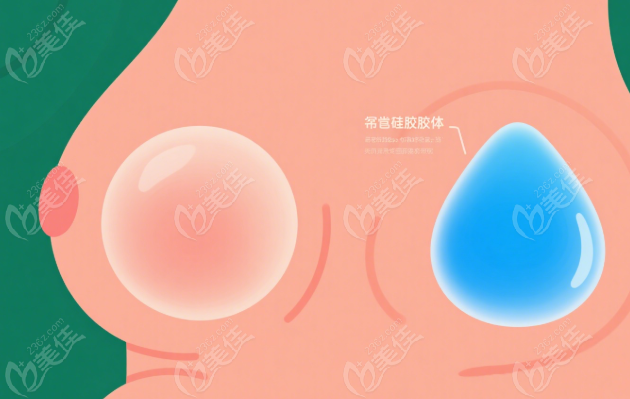 隆胸手术www.236z.com
