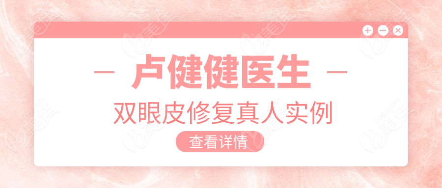 卢健健医生双眼皮修复真人实例