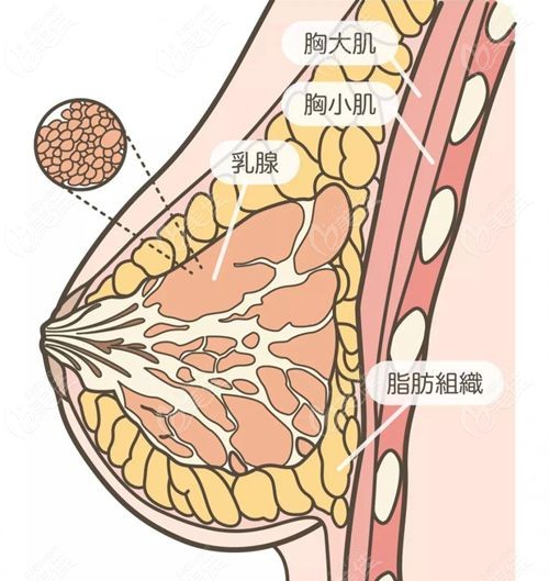 冯斌自体脂肪隆胸技术解析
