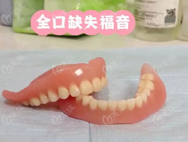全口吸附性義齒圖片