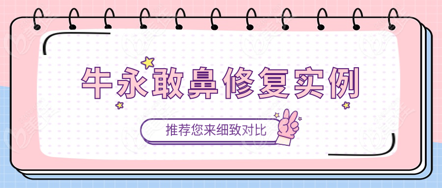 牛永敢鼻修复实例