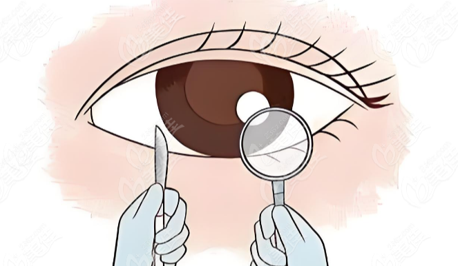 眼修复白永辉坐诊医院在：北京叶子医疗美容医院