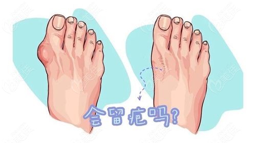 患者真实反馈