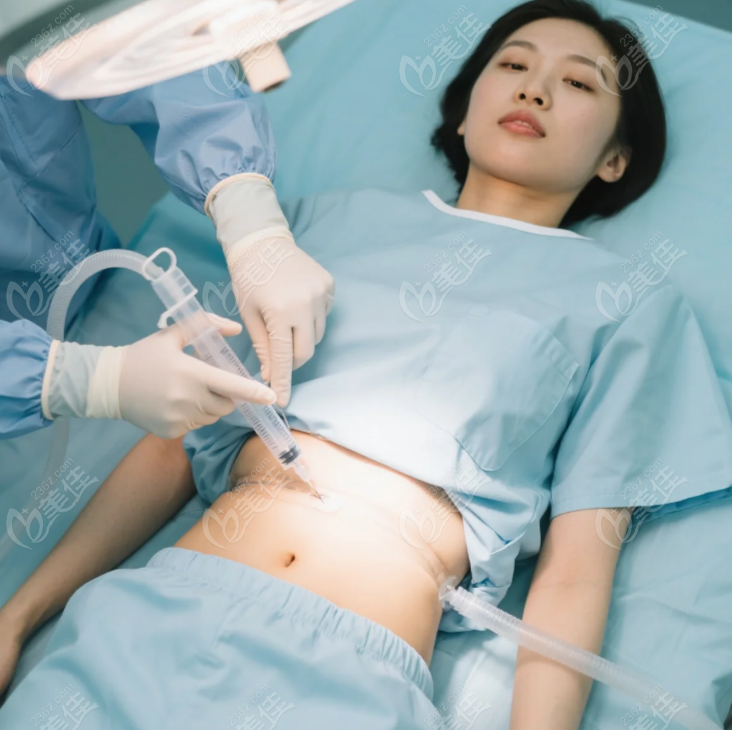 深圳黃海俠醫(yī)生抽脂怎么樣