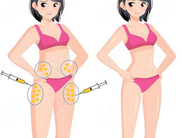 北京清木馬梅生吸脂屬于啥檔次