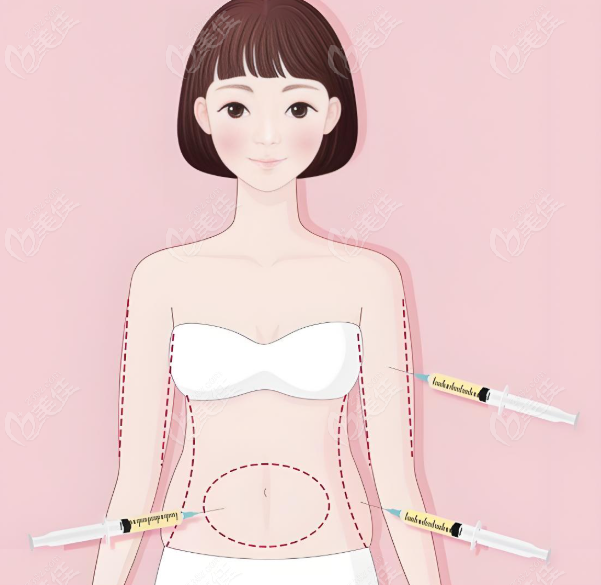 清木馬梅生吸脂