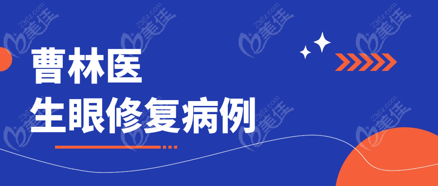 曹林医生眼修复病例