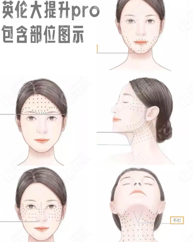 英伦大提升成效明显
