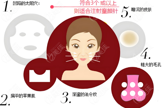 脸部不同部位童颜针注射演示