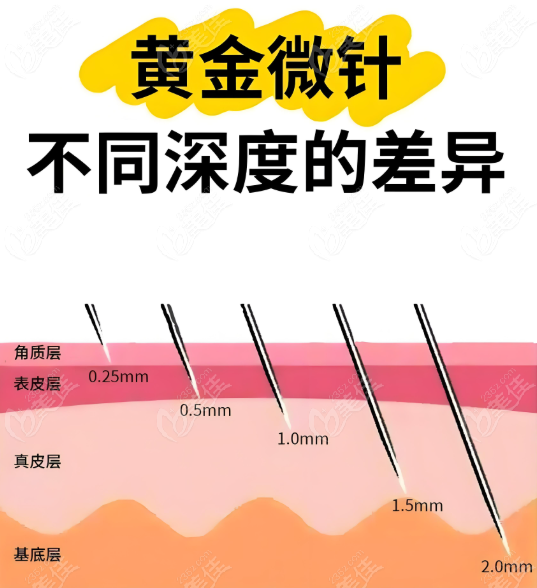 北京黃金微針醫(yī)生