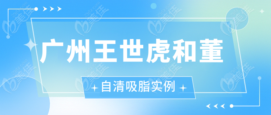 广州王世虎和董自清吸脂实例