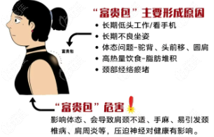 微创去富贵包