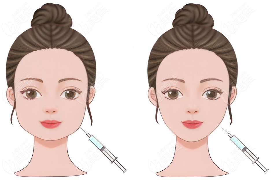 华美整形医院注射