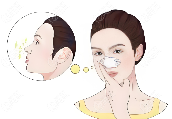 上海張鵬浩鼻子做得好嗎？