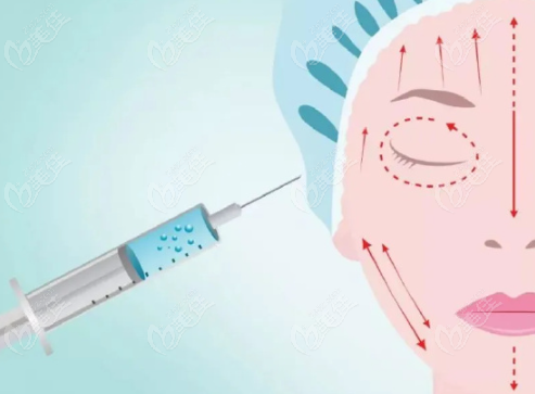 注射醫(yī)美www.pfflawyer.com