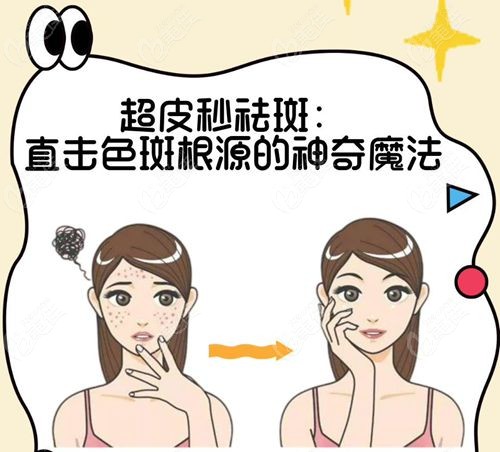 南京皮研所祛斑祛痣价格表