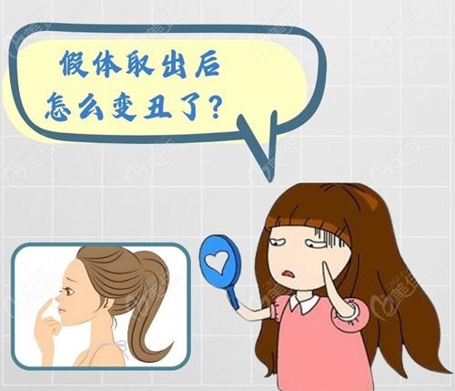 南京鼻修復(fù)口碑好的整容醫(yī)院推薦