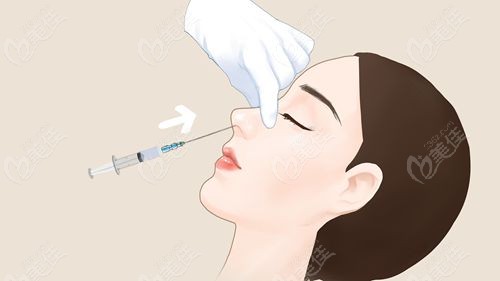 昆明注射隆鼻医生排名前十