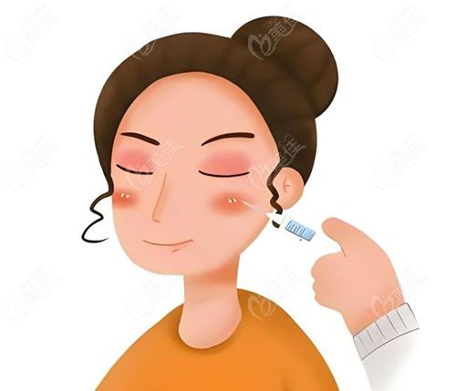  南京Ellanse少女针认证医生红榜