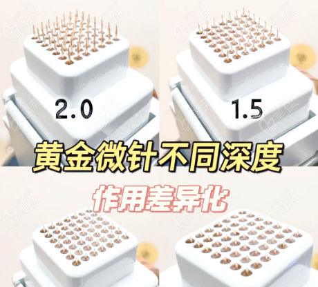 黄金微针