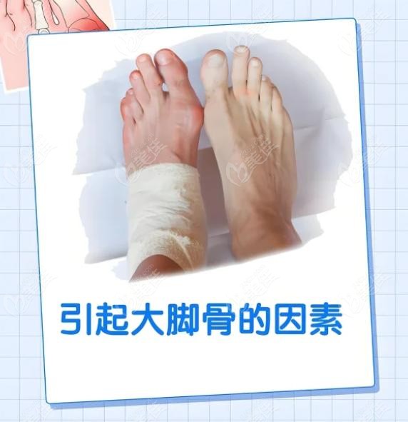 蘇敬達(dá)做大腳骨手術(shù)技術(shù)水平咋樣