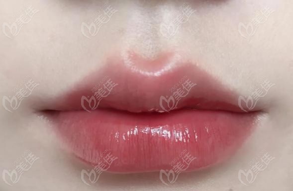 瑞藍2號打嘴唇顆粒感強嗎