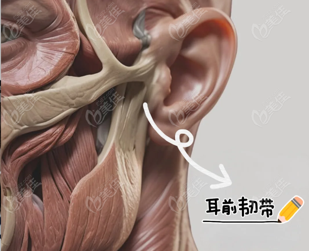 耳前韌帶提升原理大起底