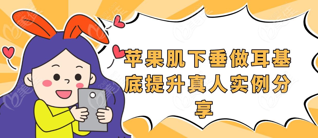 蘋果肌下垂做耳基底提升真人實例分享 