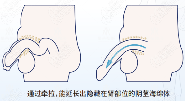 李世荣手术真实例子