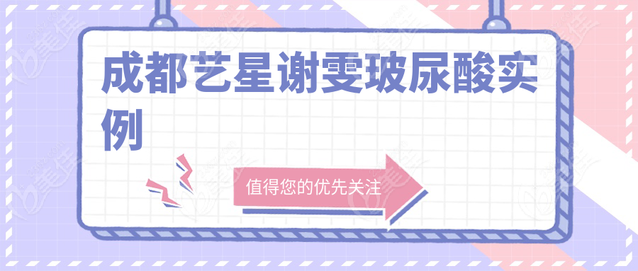 成都藝星謝雯玻尿酸實(shí)例