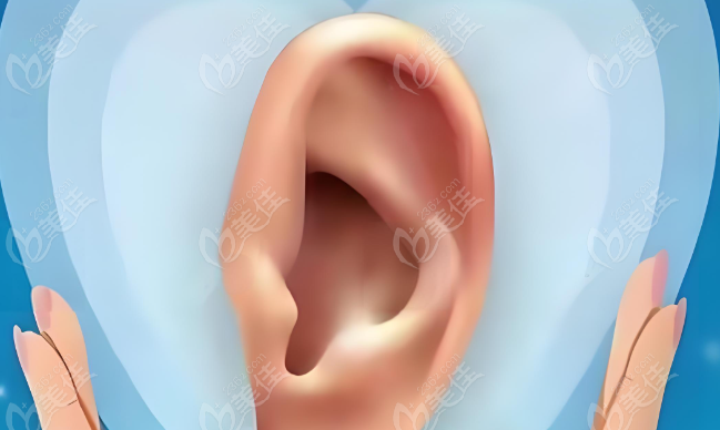 耳再造手术 耳再造手术