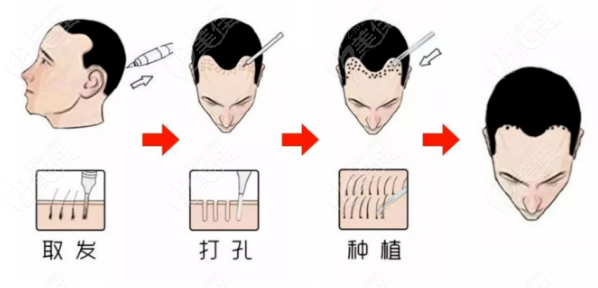 重慶植發(fā)醫(yī)院在線問診預(yù)約