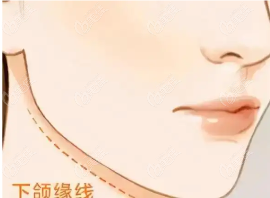 面部轮廓手术www.236z.com