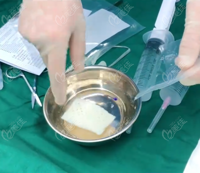 阴茎生物补片手术风险大不大